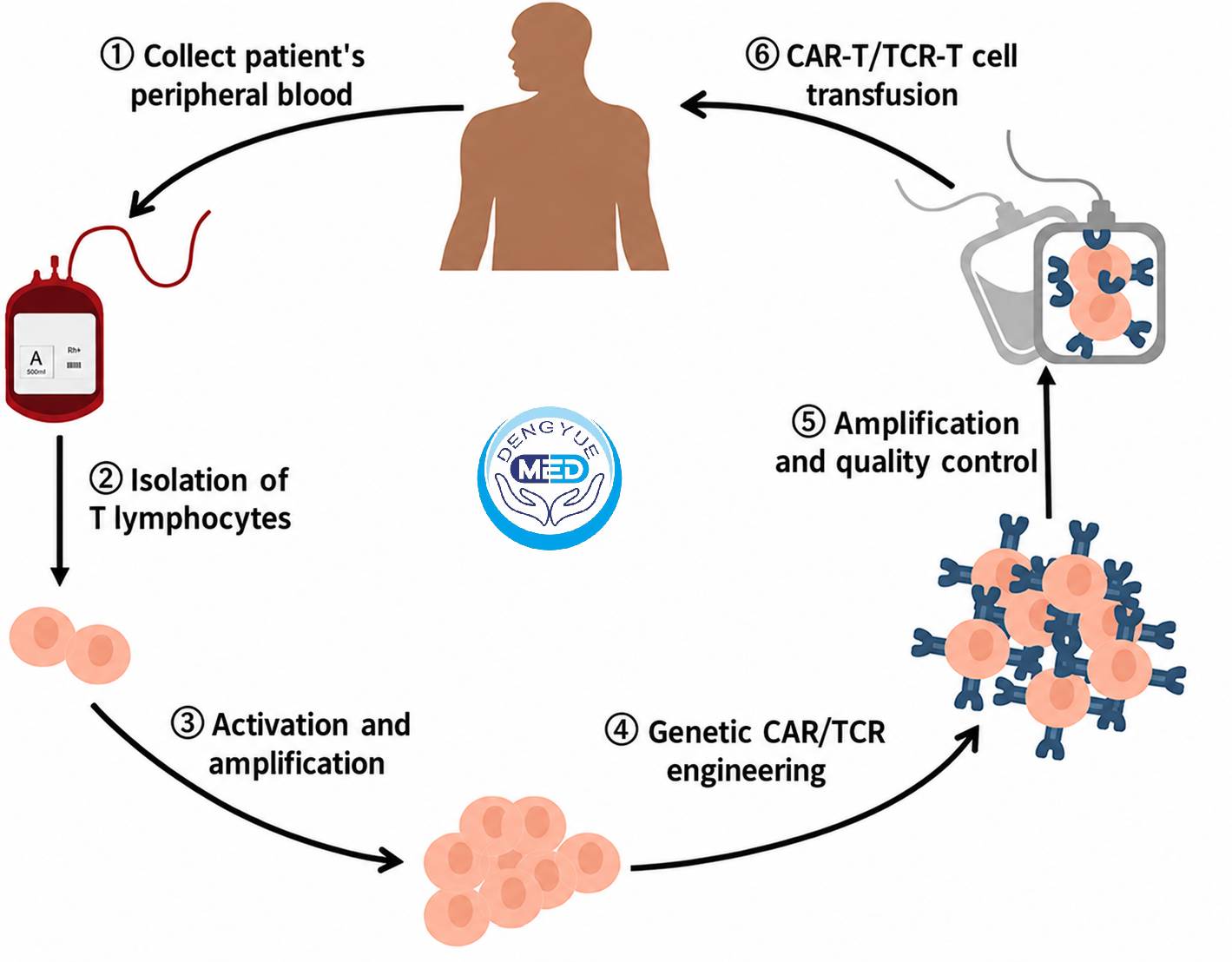 Why Can CAR-T Treatment Costs Differ by Hundreds of Thousands of Dollars?